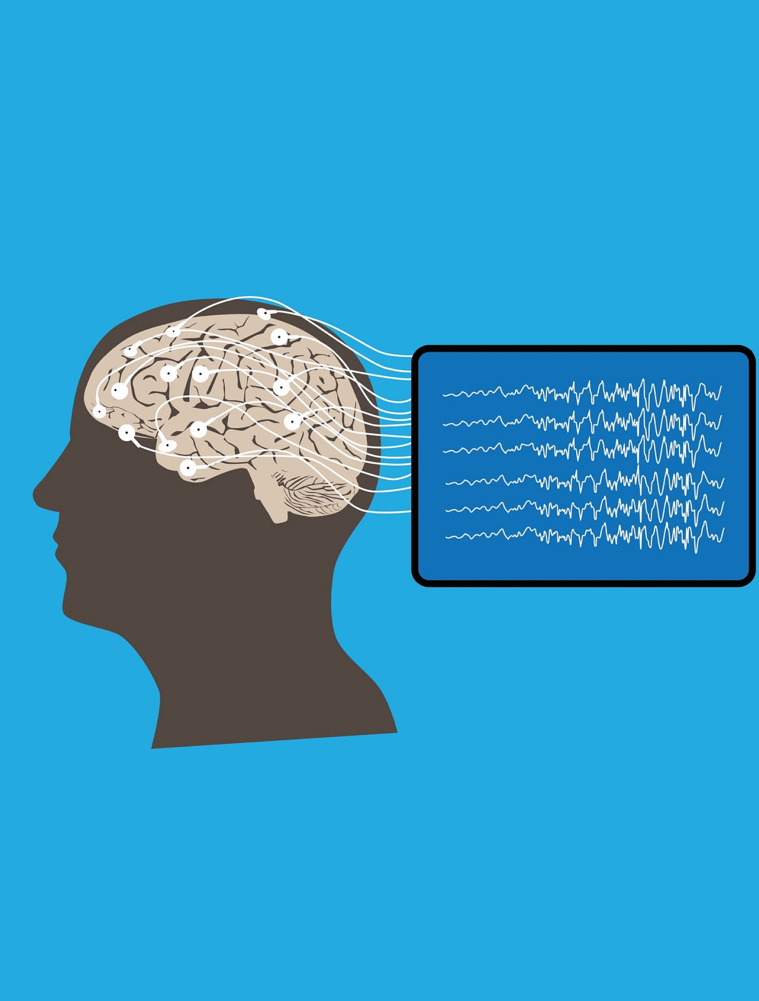 Brain Activity Monitoring